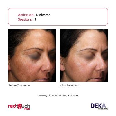 BA-Collection_RedTouch-PRO-Rev-1.0_Page_02-400x400