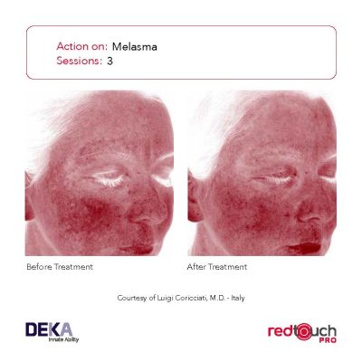 BA-Collection_RedTouch-PRO-Rev-1.0_Page_03-400x400