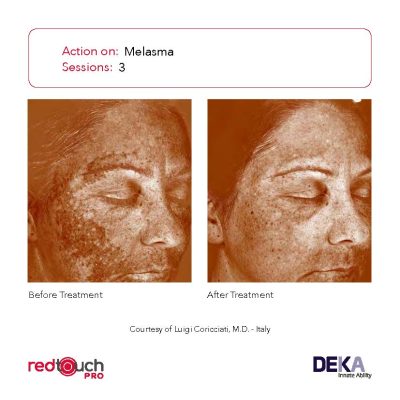 BA-Collection_RedTouch-PRO-Rev-1.0_Page_04-400x400