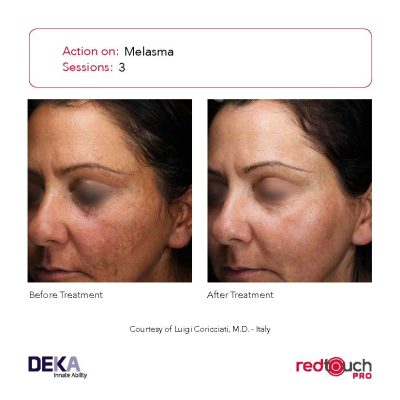 BA-Collection_RedTouch-PRO-Rev-1.0_Page_05-400x400