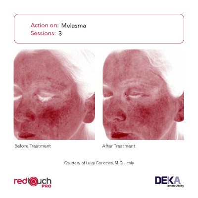 BA-Collection_RedTouch-PRO-Rev-1.0_Page_06-400x400