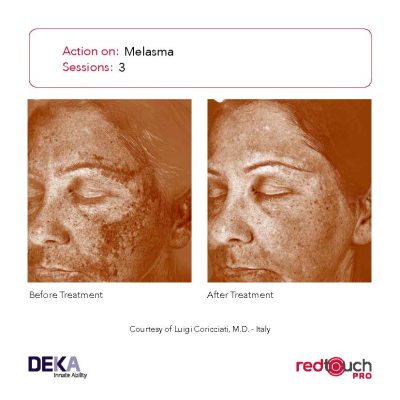 BA-Collection_RedTouch-PRO-Rev-1.0_Page_07-400x400