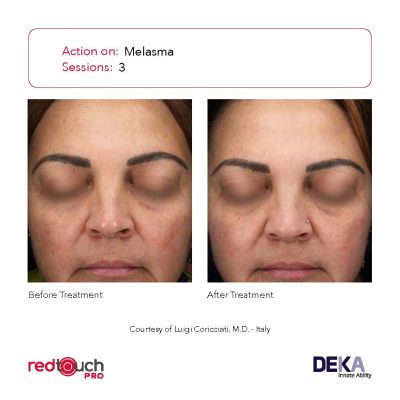 BA-Collection_RedTouch-PRO-Rev-1.0_Page_08-400x400