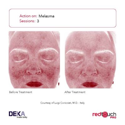 BA-Collection_RedTouch-PRO-Rev-1.0_Page_09-400x400