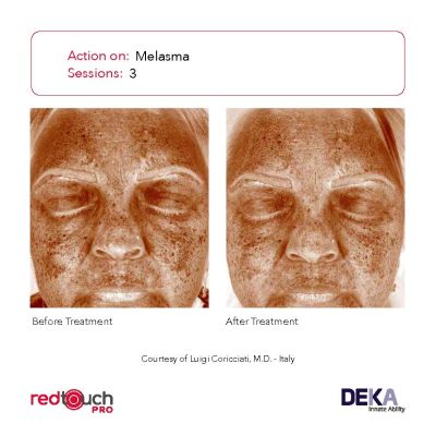 BA-Collection_RedTouch-PRO-Rev-1.0_Page_10-400x400