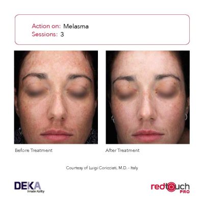 BA-Collection_RedTouch-PRO-Rev-1.0_Page_11-400x400