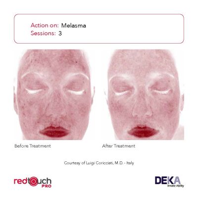 BA-Collection_RedTouch-PRO-Rev-1.0_Page_12-400x400