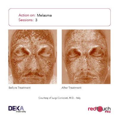 BA-Collection_RedTouch-PRO-Rev-1.0_Page_13-400x400