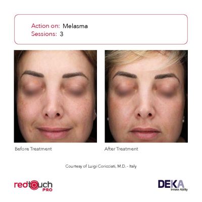 BA-Collection_RedTouch-PRO-Rev-1.0_Page_14-400x400