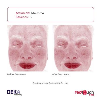 BA-Collection_RedTouch-PRO-Rev-1.0_Page_15-400x400