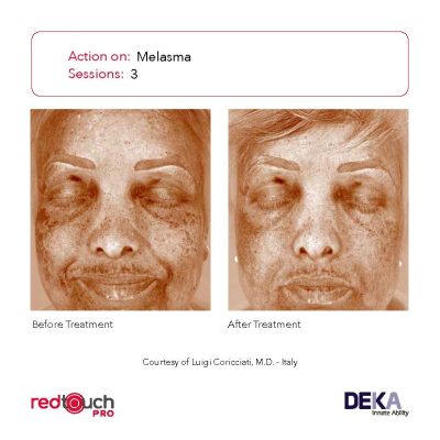 BA-Collection_RedTouch-PRO-Rev-1.0_Page_16-400x400