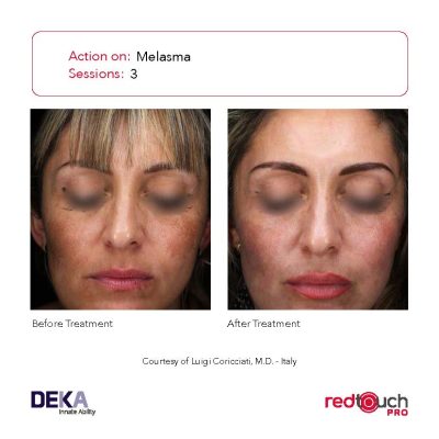 BA-Collection_RedTouch-PRO-Rev-1.0_Page_17-400x400