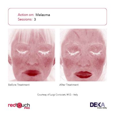 BA-Collection_RedTouch-PRO-Rev-1.0_Page_18-400x400