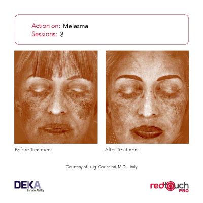 BA-Collection_RedTouch-PRO-Rev-1.0_Page_19-400x400